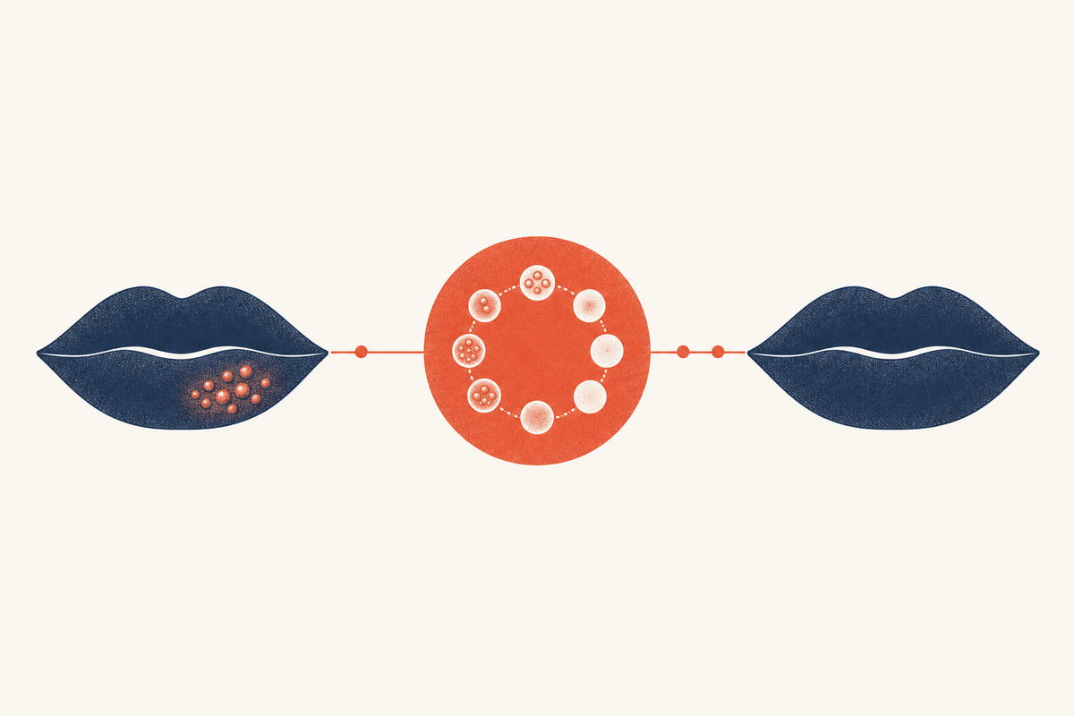 Editorial medical illustration representing the stages of a cold sore outbreak